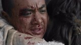 吓人！好好的姑娘，脸上怎么全是血纹