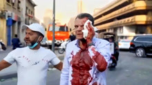 黎巴嫩港口爆炸搜救画面曝出 受伤者满脸血染红衣 用担架陆续抬出