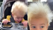 美国男婴天生拥有爱因斯坦同款发型，因患罕见难梳头发综合征